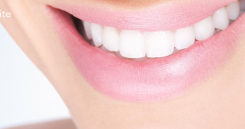 Les techniques professionnelles modernes pour le blanchiment des dents